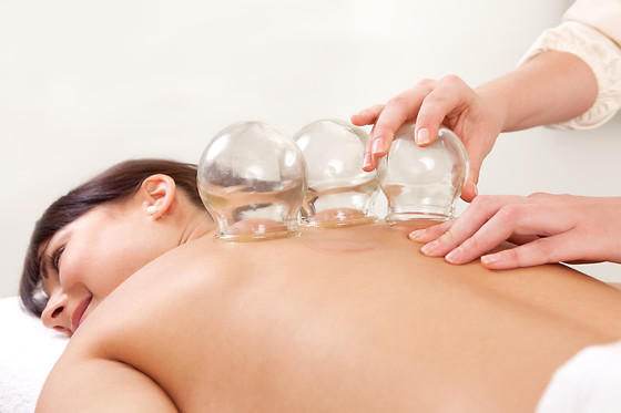 Um tratamento de ventosoterapia para 1 em Consultório de Acupuntura Yin Yang Equílibrio em Marinha Grande (Leiria)